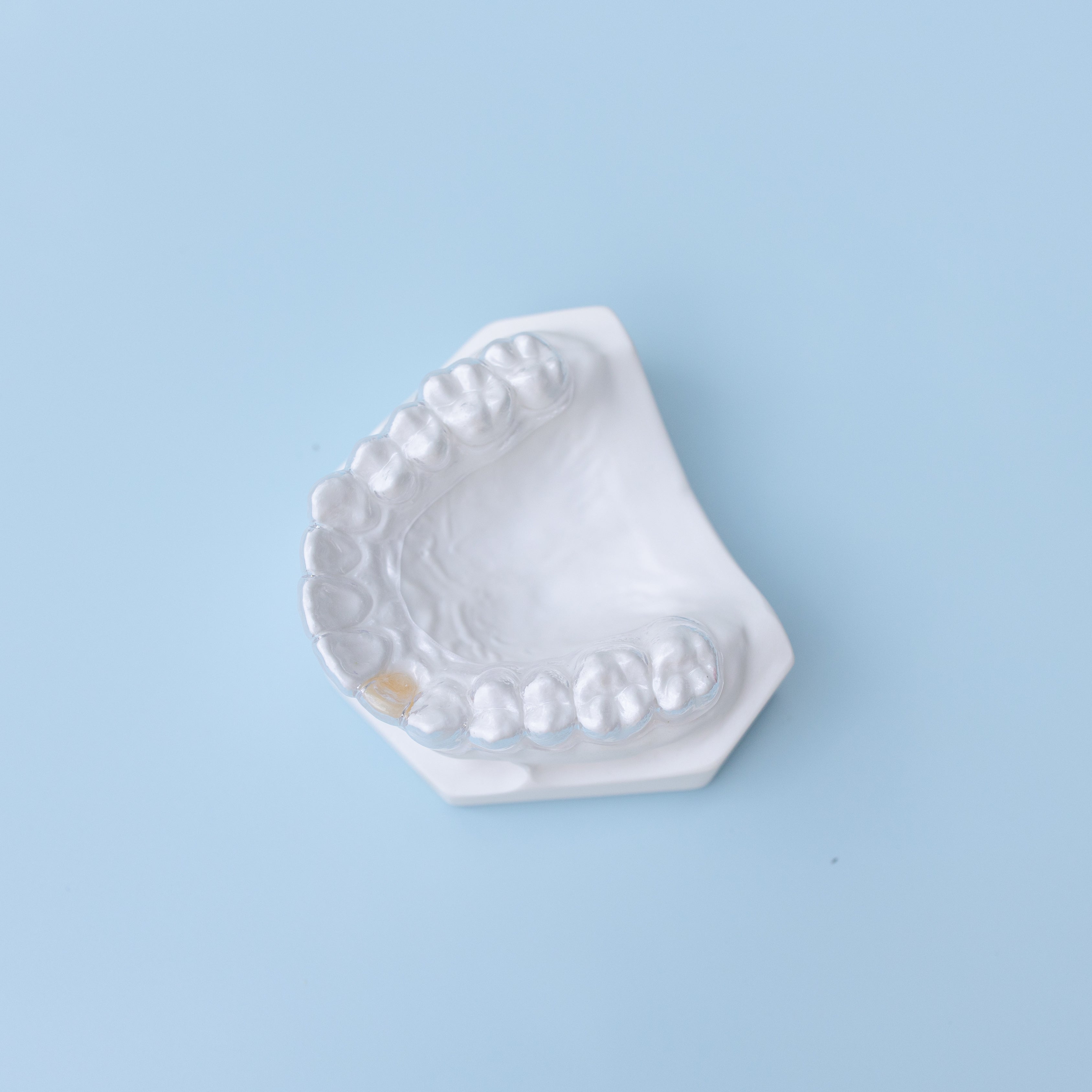 Partial Retainer ESSIX PARTIAL/DENTURE RETAINER – Dental Tech Direct