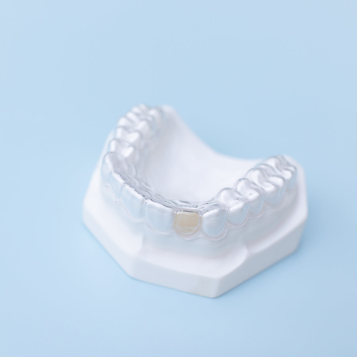 Partial Retainer ESSIX PARTIAL/DENTURE RETAINER – Dental Tech Direct